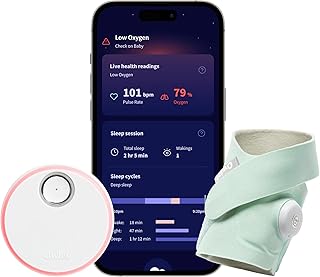 Owlet Dream Sock® - FDA-Cleared Smart Baby Monitor - Track Live Pulse (Heart) Rate, Oxygen in Infants - Receive Notifications